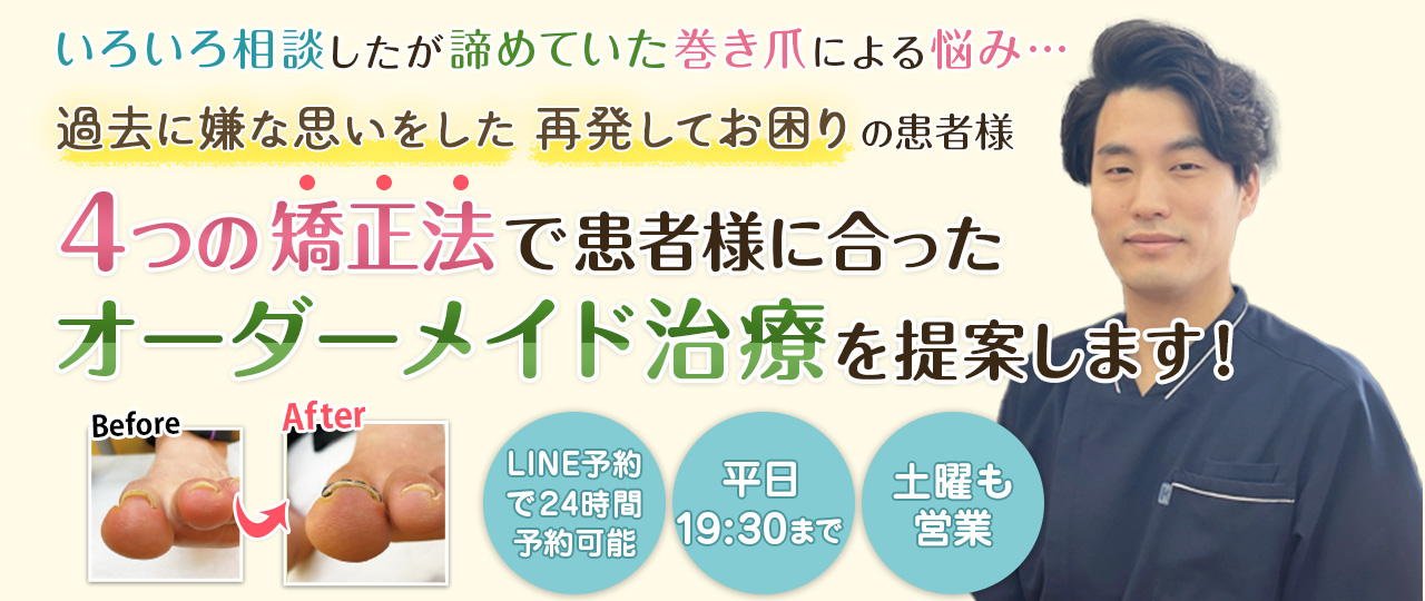 習志野市の巻き爪矯正FLAT